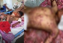 9 ਸਾਲ ਦੇ ਮਾਸੂਮ ‘ਤੇ ਕੁੱਤਿਆਂ ਨੇ ਕੀਤਾ ਹਮਲਾ, ਮਾਂ ਨੇ ਆ ਕੇ ਬਚਾਇਆ