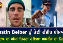 Justin Beiber ਨੂੰ ਹੋਈ ਗੰਭੀਰ ਬੀਮਾਰੀ, ਗਾਇਕ ਦਾ ਅੱਧਾ ਚਿਹਰਾ ਹੋਇਆ ਅਧਰੰਗ ਦਾ ਸ਼ਿਕਾਰ