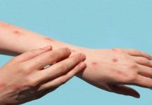 ਮੰਕੀਪੌਕਸ ਦੇ ਵਧਦੇ ਮਾਮਲਿਆਂ ਦੇ ਮੱਦੇਨਜ਼ਰ ਕੇਂਦਰ ਵੱਲੋਂ ਦਿਸ਼ਾ-ਨਿਰਦੇਸ਼ ਜਾਰੀ