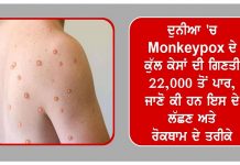 ਦੁਨੀਆ ‘ਚ Monkeypox ਦੇ ਕੁੱਲ ਕੇਸਾਂ ਦੀ ਗਿਣਤੀ 22,000 ਤੋਂ ਪਾਰ, ਜਾਣੋ ਕੀ ਹਨ ਇਸ ਦੇ ਲੱਛਣ ਅਤੇ ਰੋਕਥਾਮ ਦੇ ਤਰੀਕੇ