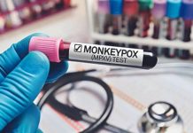 ਮੰਕੀਪਾਕਸ ਤੋਂ ਬਚਾਅ ਲਈ ਕੀ ਕਰਨਾ ਚਾਹੀਦਾ ਅਤੇ ਕੀ ਨਹੀਂ, ਕੇਂਦਰ ਸਰਕਾਰ ਵੱਲੋਂ ਐਡਵਾਇਜ਼ਰੀ ਜਾਰੀ
