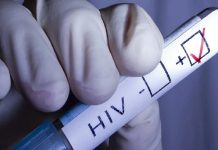 ਇੱਕੋ ਮੈਡੀਕਲ ਕਾਲਜ ‘ਚ 81 ਗਰਭਵਤੀ ਔਰਤਾਂ ਨਿਕਲੀਆਂ HIV ਪਾਜੇਟਿਵ, ਸਿਹਤ ਵਿਭਾਗ ਵਿੱਚ ਮੱਚਿਆ ਹੜਕੰਪ