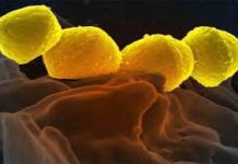 ਜਾਪਾਨ ‘ਚ ਮਾਸ ਖਾਣ ਵਾਲੇ ਬੈਕਟੀਰੀਆ ਫੈਲੇ, ਇਸ ਕਾਰਨ 48 ਘੰਟਿਆਂ ‘ਚ ਮੌਤ