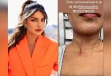 ਪ੍ਰਿਅੰਕਾ ਚੋਪੜਾ ਹੋਈ ਜ਼ਖਮੀ, ਸਟੰਟ ਕਰਦਿਆਂ ਅਦਾਕਾਰਾ ਦੀ ਗਰਦਨ ‘ਤੇ ਲੱਗਿਆ ਡੂੰਘਾ ਕੱਟ