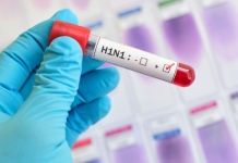 ਅਗਸਤ ‘ਚ H1N1 ਦੇ 70 ਮਾਮਲੇ, ਵਧਿਆ ਸਵਾਇਨ ਫਲੂ ਦਾ ਕਹਿਰ